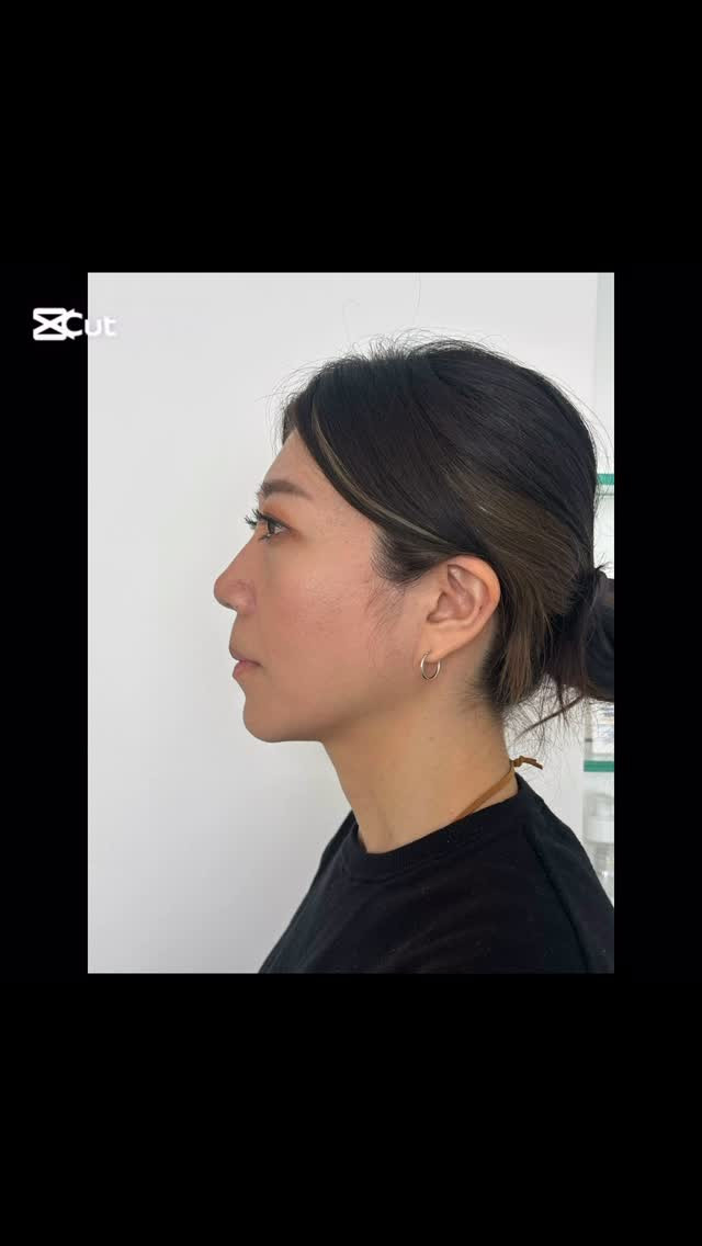 劇的変化！顔のビフォーアフター